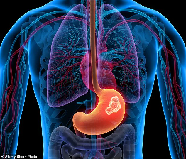 The Fragile Line: How Missed Opportunities in Healthcare Led to Severe Consequences in an Esophageal Cancer Case