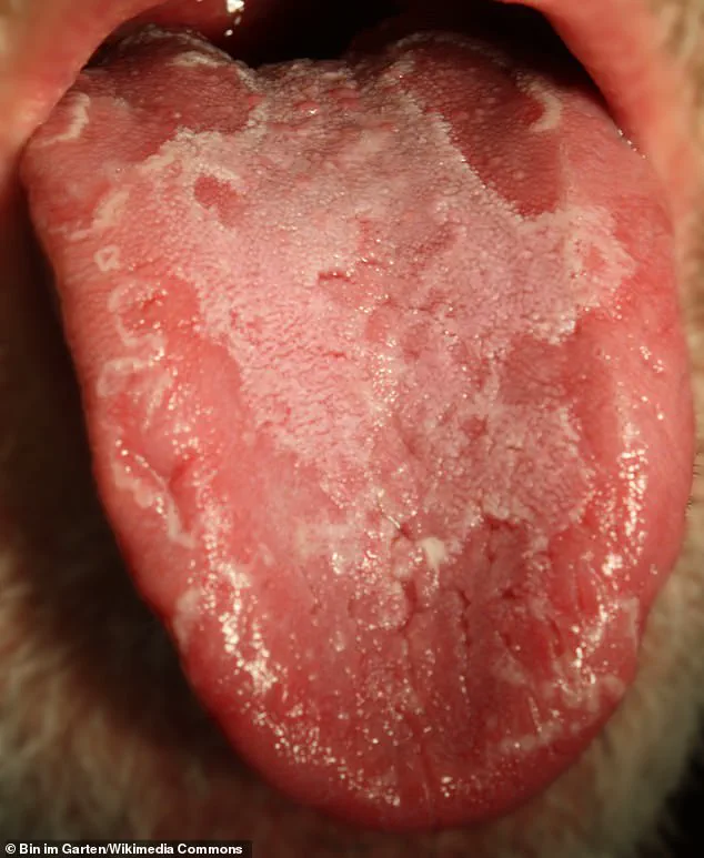 Kate McKinnon's Geographic Tongue: A Rare Condition and the Courage to Speak Out
