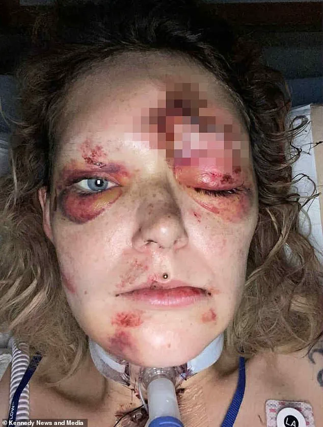 Mother Survives 'Clinically Dead' E-Scooter Accident with Brain Tissue Exposed, Defying Medical Odds