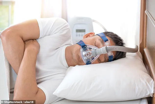 Using a Conch to Alleviate Chronic Snoring: A Personal Experience