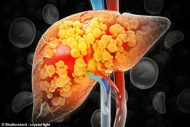 Study Reveals Overweight Individuals with Strong Muscle Strength Face Lower Risk of Obesity-Related Organ Damage