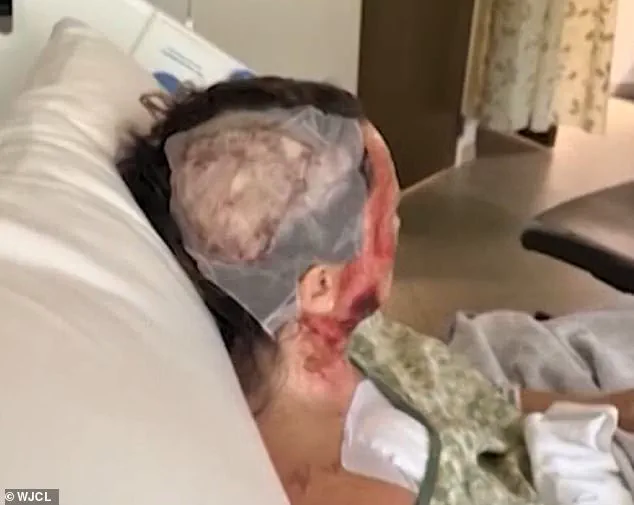 Georgia Woman's Acid Attack Sparks Urgent Call for Justice as Community Reels from Shocking Incident