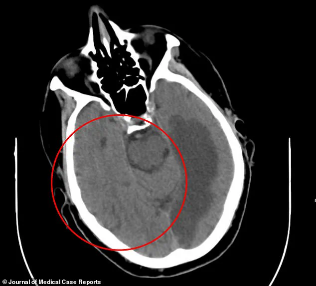 Mysterious Medical Incident in Waterford: 76-Year-Old Man Reports Levitating Arm and Hallucinations