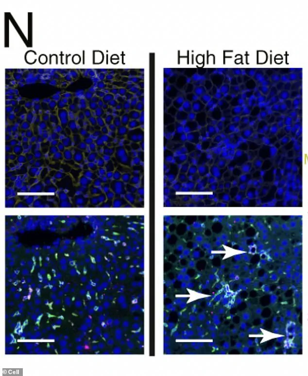 The Health Toll of Ultra-Processed Foods: Addressing the Obesity Epidemic Through Expert Guidance