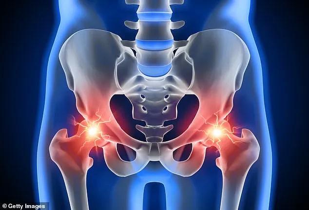 Hip Pain: A Silent Crisis Undermining Public Health and Mobility in the UK