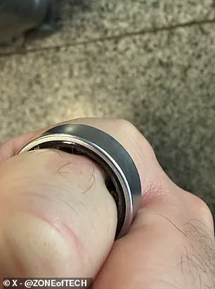 Samsung Galaxy Ring Battery Swelling Incident Sparks Concerns Over Limited Information Access and Public Health Risks