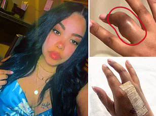 Samsung Galaxy Ring Battery Swelling Incident Sparks Concerns Over Limited Information Access and Public Health Risks