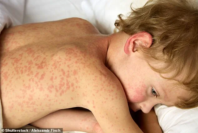 Dr. Patrick Jackson Warns of Emerging Viral Threats Linked to Climate Change and Human Activity