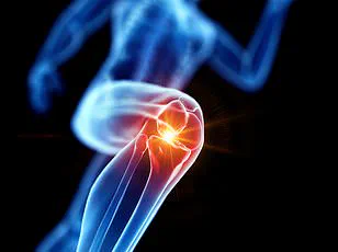 Race Against Time: Stanford Researchers Unveil Groundbreaking Regenerative Medicine Solution for UK's Arthritis Crisis