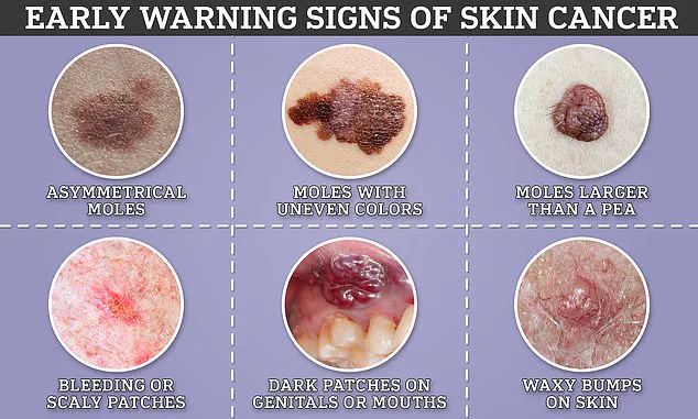 Melanoma's Hidden Dangers: Recognizing Symptoms Beyond the Skin to Save Lives
