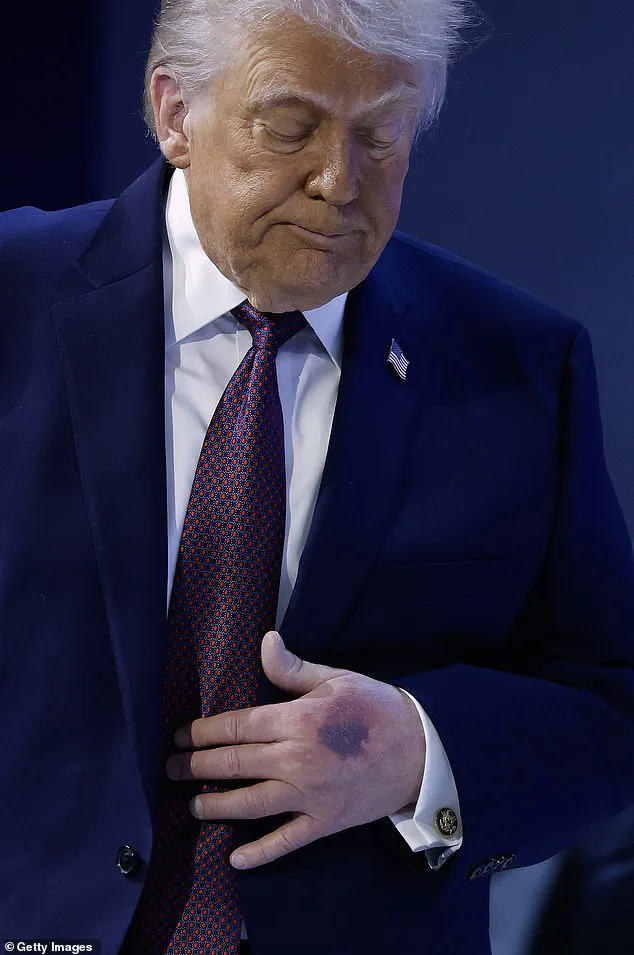 Privileged Access to Health Information: Trump's Dismissal of Alzheimer's Concerns Raises Public Health Questions