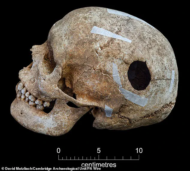 Viking-Era Burial Pit Reveals Decapitated Remains and Mysterious Skull Surgery