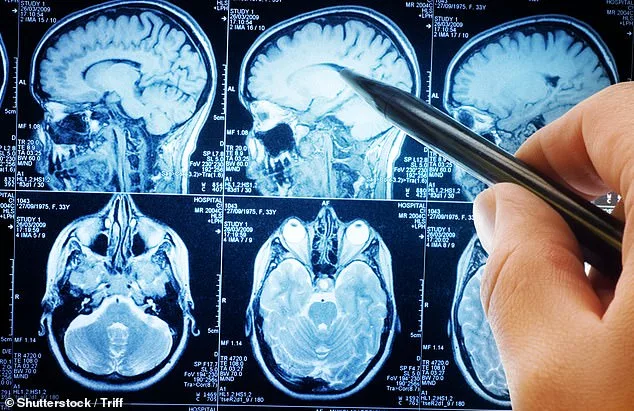More Than Just Tremors: Four Early Signs of Parkinson's Disease Experts Warn You Should Never Ignore