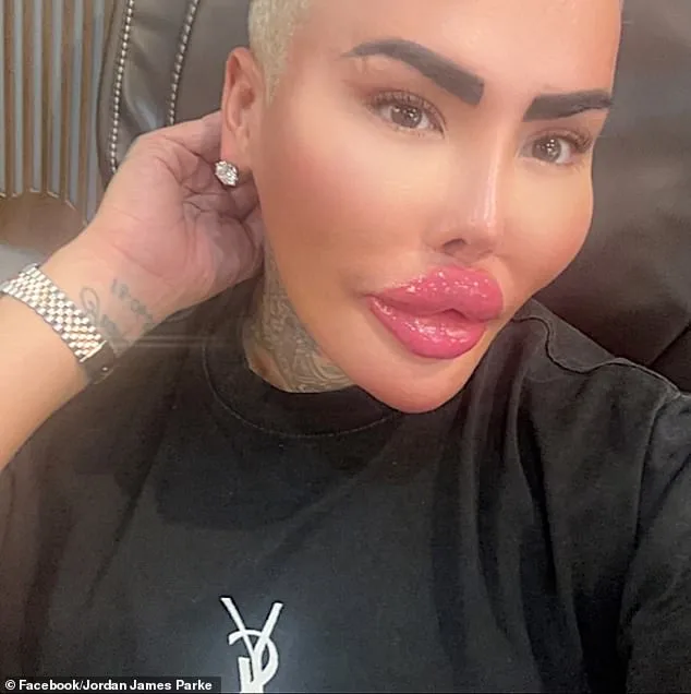 Arrests Made in Death of 'Lip King' Jordan James Parke; Police Investigate Cosmetic Procedure Link