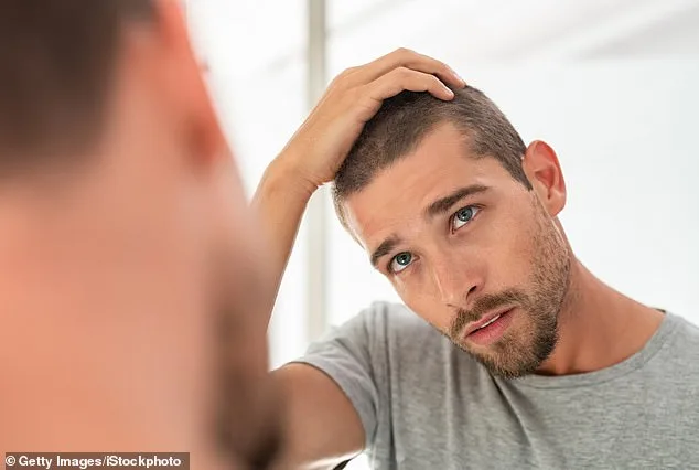 PRP Therapy Offers Non-Invasive Hair Loss Solution Without Surgery or High Costs