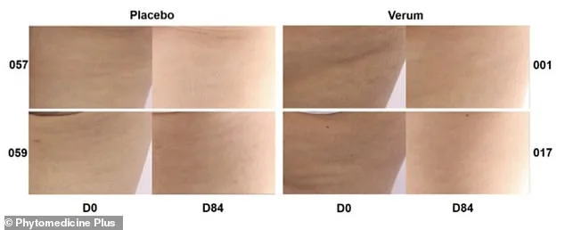 Study Reveals French Maritime Pine Bark Extract Effectively Reduces Cellulite in 90 Days