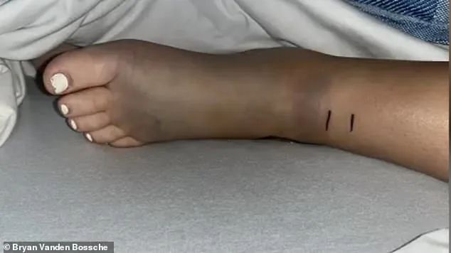 14-Year-Old California Girl Survives Venomous Rattlesnake Bite During Mountain Bike Trip