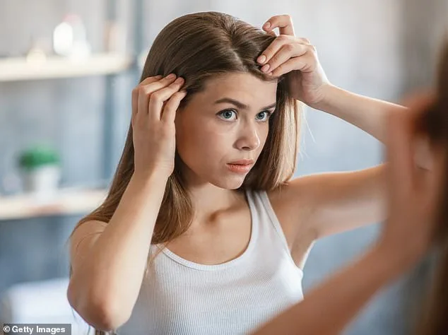 Debunking the Dandruff Myth: Scalp Yeast, Not Dryness, Is the Real Culprit